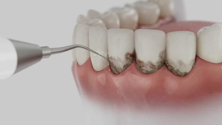 Trusted Dental Implants service in Morrow, OH - Dentist Open Now